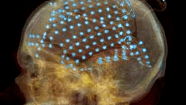 梦见在梦境中用花瓣拼凑出未来的画面,速发云资源网